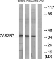 T2R7 Polyclonal Antibody