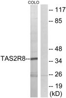 T2R8 Polyclonal Antibody