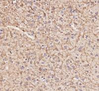 IKKβ Polyclonal Antibody