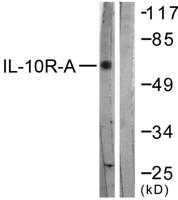 IL-10Rα Polyclonal Antibody