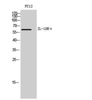 IL-10Rα Polyclonal Antibody