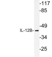 IL-12B Polyclonal Antibody