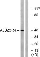 ALS2CR4 Polyclonal Antibody