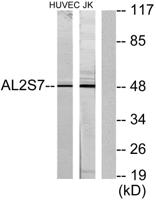 ALS2CR7 Polyclonal Antibody