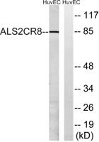 ALS2CR8 Polyclonal Antibody