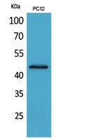 IL-1RII Polyclonal Antibody