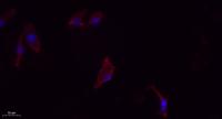 IL-2 Polyclonal Antibody