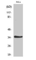 IL-20Rβ Polyclonal Antibody