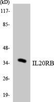 IL-20Rβ Polyclonal Antibody