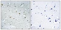 TACC1 Polyclonal Antibody