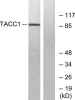 TACC1 Polyclonal Antibody