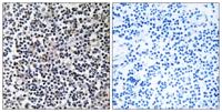 TACC3 Polyclonal Antibody