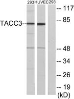 TACC3 Polyclonal Antibody