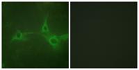 TACE Polyclonal Antibody