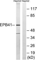 4.1R Polyclonal Antibody