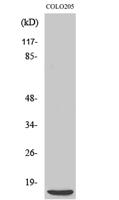 4E-BP1 Polyclonal Antibody