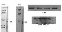 α-SMA Polyclonal Antibody