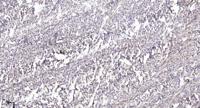 Relaxin Receptor 2 Polyclonal Antibody