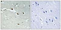 FoxJ1 Polyclonal Antibody