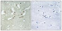 FoxJ3 Polyclonal Antibody