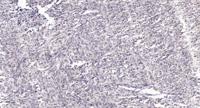 FoxL1 Polyclonal Antibody