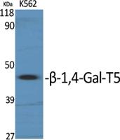 β-1,4-Gal-T5 Polyclonal Antibody