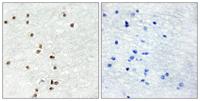 Zic1/2/3 Polyclonal Antibody