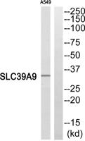 ZIP9 Polyclonal Antibody