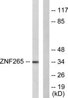 ZIS Polyclonal Antibody