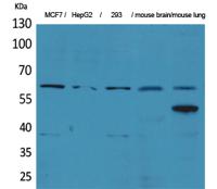 ZKSCAN4 Polyclonal Antibody