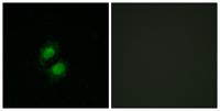 ZKSCAN5 Polyclonal Antibody