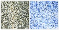 ZNF225 Polyclonal Antibody