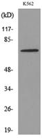 Transferrin Polyclonal Antibody