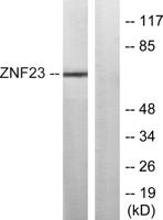 ZNF23 Polyclonal Antibody