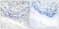 TRAP230 Polyclonal Antibody