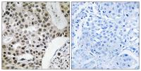 ZNF262 Polyclonal Antibody