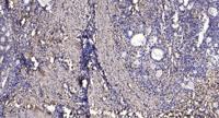 TRAPPC5 Polyclonal Antibody