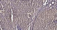 ZNF337 Polyclonal Antibody