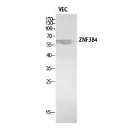 ZNF384 Polyclonal Antibody