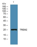 TREM2 Polyclonal Antibody