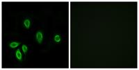 TRH-R1 Polyclonal Antibody