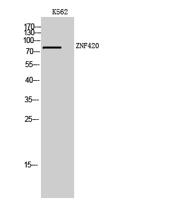 ZNF420 Polyclonal Antibody