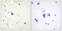 TRIM3 Polyclonal Antibody