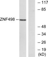 ZNF498 Polyclonal Antibody