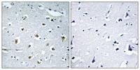 TRIP15 Polyclonal Antibody