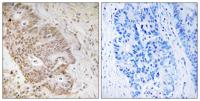 ZNF592 Polyclonal Antibody