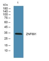 ZNF691 Polyclonal Antibody