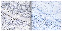 ZNF76 Polyclonal Antibody