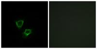 ZNRF2 Polyclonal Antibody