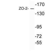 ZO-2 Polyclonal Antibody